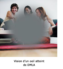 La DMLA